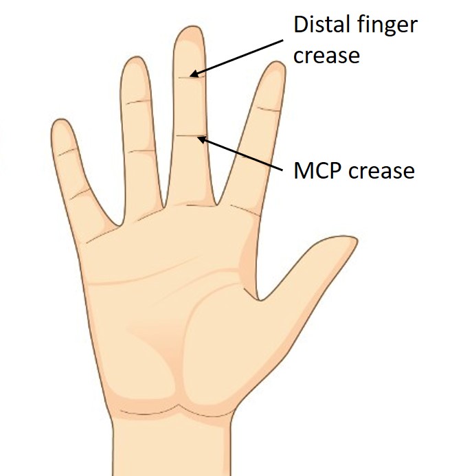 Rolyan Sof Stretch Short Finger Splint Medicalsupplies Co Uk