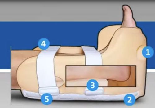 Heelift Glide Heel Suspension Pressure Relief Boot Anatomy